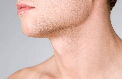 How Much Does A Male Neck Lift Cost in Raleigh