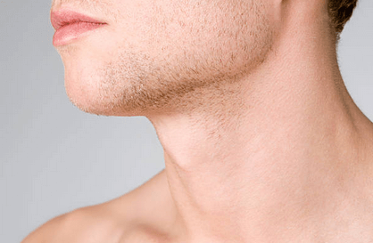 How Much Does a Male Neck Lift Cost in Raleigh