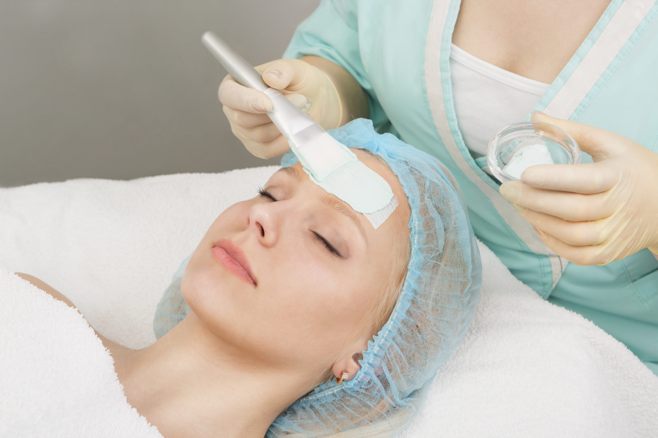 Chemical Peel Raleigh